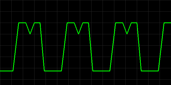 Capnography waveform